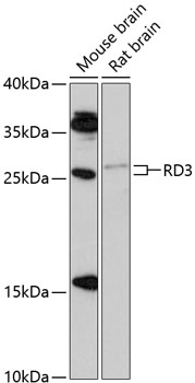 Western blot analysis of extracts of various cell lines, using RD3 antibody (TA380822) at 1:1000 dilution. - Secondary antibody: HRP Goat Anti-Rabbit IgG (H+L) at 1:10000 dilution. - Lysates/proteins: 25ug per lane. - Blocking buffer: 3% nonfat dry milk in TBST. - Detection: ECL Enhanced Kit . - Exposure time: 90s.
