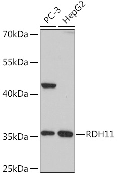 Surface staining of CD45R in murine splenocytes with anti-CD45R (RA3-6B2) PE.