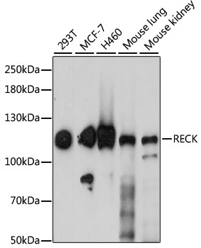 Western blot analysis of extracts of various cell lines, using RECK antibody (TA380830) at 1:1000 dilution. - Secondary antibody: HRP Goat Anti-Rabbit IgG (H+L) at 1:10000 dilution. - Lysates/proteins: 25ug per lane. - Blocking buffer: 3% nonfat dry milk in TBST. - Detection: ECL Enhanced Kit . - Exposure time: 60s.