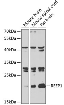 Staining of mouse peripheral blood lymphocytes with RAT ANTI MOUSE CD49d: LOW ENDOTOXIN