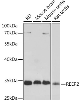 Western blot analysis of extracts of various cell lines, using REEP2 Rabbit pAb (TA380834) at 1:1000 dilution. - Secondary antibody: HRP Goat Anti-Rabbit IgG (H+L) at 1:10000 dilution. - Lysates/proteins: 25ug per lane. - Blocking buffer: 3% nonfat dry milk in TBST. - Detection: ECL Basic Kit . - Exposure time: 5s.
