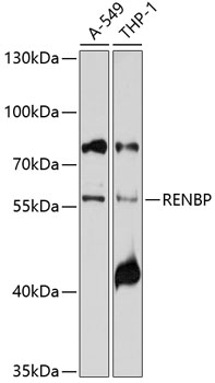Flow Cytometry: SM049P CD90 Antibody Staining of Rat thymocytes.