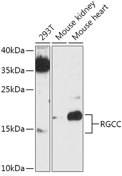 Western blot analysis of extracts of various cell lines, using RGCC antibody (TA380880) at 1:1000 dilution. - Secondary antibody: HRP Goat Anti-Rabbit IgG (H+L) at 1:10000 dilution. - Lysates/proteins: 25ug per lane. - Blocking buffer: 3% nonfat dry milk in TBST. - Detection: ECL Enhanced Kit . - Exposure time: 90s.