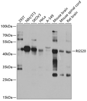 Western blot analysis of extracts of various cell lines, using RGS20 antibody (TA380891) at 1:1000 dilution. - Secondary antibody: HRP Goat Anti-Rabbit IgG (H+L) at 1:10000 dilution. - Lysates/proteins: 25ug per lane. - Blocking buffer: 3% nonfat dry milk in TBST. - Detection: ECL Basic Kit . - Exposure time: 15s.