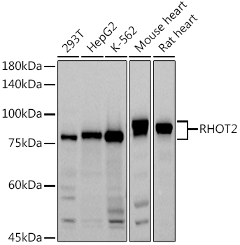 Western blot analysis of extracts of various cell lines, using (TA380922) at 1:1000 dilution. - Secondary antibody: HRP Goat Anti-Rabbit IgG (H+L) at 1:10000 dilution. - Lysates/proteins: 25ug per lane. - Blocking buffer: 3% nonfat dry milk in TBST. - Detection: ECL Basic Kit . - Exposure time: 30s.