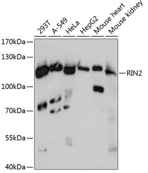 Western blot analysis of extracts of various cell lines, using RIN2 antibody (TA380930) at 1:3000 dilution. - Secondary antibody: HRP Goat Anti-Rabbit IgG (H+L) at 1:10000 dilution. - Lysates/proteins: 25ug per lane. - Blocking buffer: 3% nonfat dry milk in TBST. - Detection: ECL Basic Kit . - Exposure time: 30s.