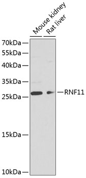 Western blot analysis of extracts of various cell lines, using RNF11 antibody (TA380965) at 1:1000 dilution. - Secondary antibody: HRP Goat Anti-Rabbit IgG (H+L) at 1:10000 dilution. - Lysates/proteins: 25ug per lane. - Blocking buffer: 3% nonfat dry milk in TBST. - Detection: ECL Basic Kit . - Exposure time: 60s.