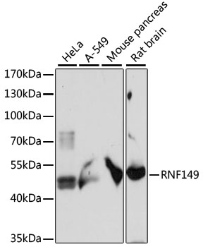 Western blot analysis of extracts of various cell lines, using RNF149 antibody (TA380979) at 1:1000 dilution. - Secondary antibody: HRP Goat Anti-Rabbit IgG (H+L) at 1:10000 dilution. - Lysates/proteins: 25ug per lane. - Blocking buffer: 3% nonfat dry milk in TBST. - Detection: ECL Basic Kit . - Exposure time: 30s.