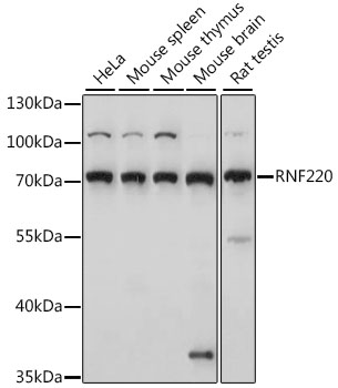 Western blot analysis of extracts of various cell lines, using RNF220 antibody (TA380994) at 1:1000 dilution. - Secondary antibody: HRP Goat Anti-Rabbit IgG (H+L) at 1:10000 dilution. - Lysates/proteins: 25ug per lane. - Blocking buffer: 3% nonfat dry milk in TBST. - Detection: ECL Basic Kit . - Exposure time: 30s.