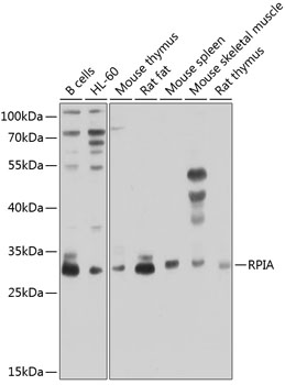 Western blot analysis of extracts of various cell lines, using RPIA antibody (TA381032) at 1:1000 dilution. - Secondary antibody: HRP Goat Anti-Rabbit IgG (H+L) at 1:10000 dilution. - Lysates/proteins: 25ug per lane. - Blocking buffer: 3% nonfat dry milk in TBST. - Detection: ECL Enhanced Kit . - Exposure time: 30s.