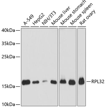 Western blot analysis of extracts of various cell lines, using RPL32 antibody (TA381057) at 1:3000 dilution. - Secondary antibody: HRP Goat Anti-Rabbit IgG (H+L) at 1:10000 dilution. - Lysates/proteins: 25ug per lane. - Blocking buffer: 3% nonfat dry milk in TBST. - Detection: ECL Basic Kit . - Exposure time: 1s.