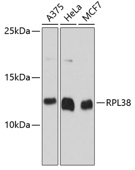 Western blot analysis of extracts of various cell lines, using RPL38 antibody (TA381065) at 1:3000 dilution. - Secondary antibody: HRP Goat Anti-Rabbit IgG (H+L) at 1:10000 dilution. - Lysates/proteins: 25ug per lane. - Blocking buffer: 3% nonfat dry milk in TBST. - Detection: ECL Basic Kit . - Exposure time: 30s.