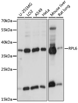 Western blot analysis of extracts of various cell lines, using RPL6 antibody (TA381067) at 1:1000 dilution. - Secondary antibody: HRP Goat Anti-Rabbit IgG (H+L) at 1:10000 dilution. - Lysates/proteins: 25ug per lane. - Blocking buffer: 3% nonfat dry milk in TBST. - Detection: ECL Basic Kit . - Exposure time: 1s.