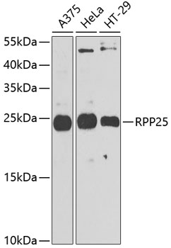 Western blot analysis of extracts of various cell lines, using RPP25 antibody (TA381080) at 1:1000 dilution. - Secondary antibody: HRP Goat Anti-Rabbit IgG (H+L) at 1:10000 dilution. - Lysates/proteins: 25ug per lane. - Blocking buffer: 3% nonfat dry milk in TBST. - Detection: ECL Enhanced Kit . - Exposure time: 90s.