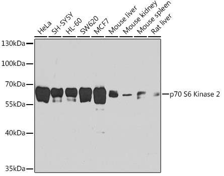 Western blot analysis of extracts of various cell lines, using p70 S6 Kinase 2 antibody (TA381139) at 1:1000 dilution. - Secondary antibody: HRP Goat Anti-Rabbit IgG (H+L) at 1:10000 dilution. - Lysates/proteins: 25ug per lane. - Blocking buffer: 3% nonfat dry milk in TBST. - Detection: ECL Basic Kit . - Exposure time: 60s.