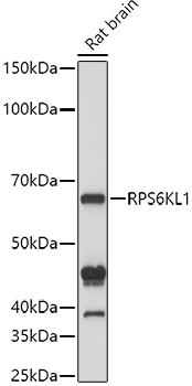 Western blot analysis of extracts of Rat brain cells, using RPS6KL1 antibody (TA381141) at 1:1000 dilution. - Secondary antibody: HRP Goat Anti-Rabbit IgG (H+L) at 1:10000 dilution. - Lysates/proteins: 25ug per lane. - Blocking buffer: 3% nonfat dry milk in TBST. - Detection: ECL Basic Kit . - Exposure time: 10s.
