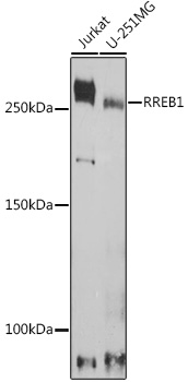 Surface staining of human peripheral blood with anti-CD48 (MEM-102) PE.