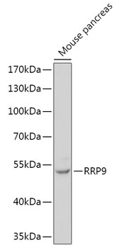 Western blot analysis of extracts of Mouse pancreas, using RRP9 antibody (TA381166) at 1:1000 dilution. - Secondary antibody: HRP Goat Anti-Rabbit IgG (H+L) at 1:10000 dilution. - Lysates/proteins: 25ug per lane. - Blocking buffer: 3% nonfat dry milk in TBST. - Detection: ECL Basic Kit . - Exposure time: 90s.