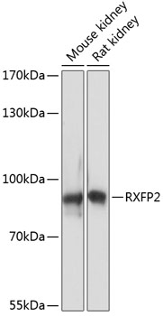 Western blot analysis of extracts of various cell lines, using RXFP2 antibody (TA381201) at 1:3000 dilution. - Secondary antibody: HRP Goat Anti-Rabbit IgG (H+L) at 1:10000 dilution. - Lysates/proteins: 25ug per lane. - Blocking buffer: 3% nonfat dry milk in TBST. - Detection: ECL Basic Kit . - Exposure time: 30s.