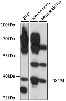 Western blot analysis of extracts of various cell lines, using RXFP4 antibody (TA381204) at 1:1000 dilution. - Secondary antibody: HRP Goat Anti-Rabbit IgG (H+L) at 1:10000 dilution. - Lysates/proteins: 25ug per lane. - Blocking buffer: 3% nonfat dry milk in TBST. - Detection: ECL Enhanced Kit . - Exposure time: 1s.