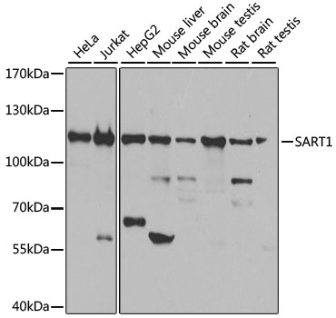 Western blot analysis of extracts of various cell lines, using SART1 antibody (TA381257) at 1:1000 dilution. - Secondary antibody: HRP Goat Anti-Rabbit IgG (H+L) at 1:10000 dilution. - Lysates/proteins: 25ug per lane. - Blocking buffer: 3% nonfat dry milk in TBST. - Detection: ECL Basic Kit . - Exposure time: 10s.