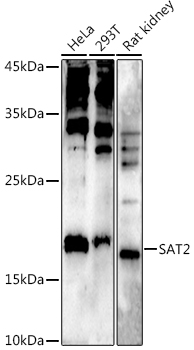Staining of HUT78 T cells with Mouse anti Human CD90-FITC (F15-42-1)