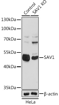 Western blot analysis of extracts from normal (control) and [KO Validated] SAV1 knockout (KO) HeLa cells, using [KO Validated] SAV1 antibody (TA381263) at 1:1000 dilution. - Secondary antibody: HRP Goat Anti-Rabbit IgG (H+L) at 1:10000 dilution. - Lysates/proteins: 25ug per lane. - Blocking buffer: 3% nonfat dry milk in TBST. - Detection: ECL Basic Kit . - Exposure time: 90s.