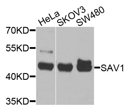 Western blot analysis of extracts of various cell lines, using SAV1 antibody (TA381264) at 1:1000 dilution. - Secondary antibody: HRP Goat Anti-Rabbit IgG (H+L) at 1:10000 dilution. - Lysates/proteins: 25ug per lane. - Blocking buffer: 3% nonfat dry milk in TBST. - Detection: ECL Basic Kit . - Exposure time: 30s.