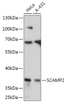Western blot analysis of extracts of various cell lines, using SCAMP2 antibody (TA381269) at 1:1000 dilution. - Secondary antibody: HRP Goat Anti-Rabbit IgG (H+L) at 1:10000 dilution. - Lysates/proteins: 25ug per lane. - Blocking buffer: 3% nonfat dry milk in TBST. - Detection: ECL Basic Kit . - Exposure time: 10s.