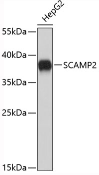 Western blot analysis of extracts of HepG2 cells, using SCAMP2 antibody (TA381270). - Secondary antibody: HRP Goat Anti-Rabbit IgG (H+L) at 1:10000 dilution. - Lysates/proteins: 25ug per lane. - Blocking buffer: 3% nonfat dry milk in TBST.