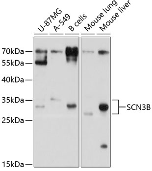 Western blot analysis of extracts of various cell lines, using SCN3B antibody (TA381291) at 1:1000 dilution. - Secondary antibody: HRP Goat Anti-Rabbit IgG (H+L) at 1:10000 dilution. - Lysates/proteins: 25ug per lane. - Blocking buffer: 3% nonfat dry milk in TBST. - Detection: ECL Basic Kit . - Exposure time: 5s.
