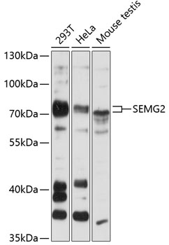Western blot analysis of extracts of various cell lines, using SEMG2 antibody (TA381353) at 1:3000 dilution. - Secondary antibody: HRP Goat Anti-Rabbit IgG (H+L) at 1:10000 dilution. - Lysates/proteins: 25ug per lane. - Blocking buffer: 3% nonfat dry milk in TBST. - Detection: ECL Basic Kit . - Exposure time: 30s.