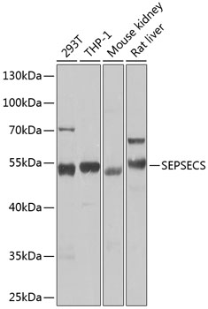 Immunohistochemistry: SM1372P/PT TNNT3 antibody staining of Formalin-Fixed, Paraffin-Embedded Human Skeletal Muscle at 10 g/ml followed by biotinylated secondary antibody, alkaline phosphatase-streptavidin and chromogen.