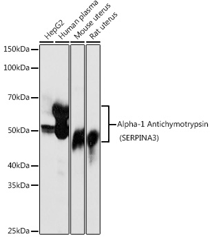 Western blot analysis of extracts of various cell lines, using Alpha-1 Antichymotrypsin (Alpha-1 Antichymotrypsin (SERPINA3)) antibody (TA381370) at 1:1000 dilution. - Secondary antibody: HRP Goat Anti-Rabbit IgG (H+L) at 1:10000 dilution. - Lysates/proteins: 25ug per lane. - Blocking buffer: 3% nonfat dry milk in TBST. - Detection: ECL Basic Kit . - Exposure time: 30s.