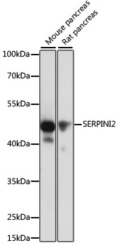 Western blot analysis of extracts of various cell lines, using SERPINI2 antibody (TA381395) at 1:1000 dilution. - Secondary antibody: HRP Goat Anti-Rabbit IgG (H+L) at 1:10000 dilution. - Lysates/proteins: 25ug per lane. - Blocking buffer: 3% nonfat dry milk in TBST. - Detection: ECL Basic Kit . - Exposure time: 10s.