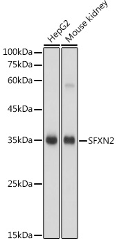 Western blot analysis of extracts of various cell lines, using SFXN2 antibody (TA381437) at 1:1000 dilution. - Secondary antibody: HRP Goat Anti-Rabbit IgG (H+L) at 1:10000 dilution. - Lysates/proteins: 25ug per lane. - Blocking buffer: 3% nonfat dry milk in TBST. - Detection: ECL Basic Kit . - Exposure time: 1s.