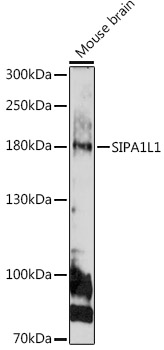 Western blot analysis of extracts of Mouse brain, using SIPA1L1 antibody (TA381502) at 1:1000 dilution. - Secondary antibody: HRP Goat Anti-Rabbit IgG (H+L) at 1:10000 dilution. - Lysates/proteins: 25ug per lane. - Blocking buffer: 3% nonfat dry milk in TBST. - Detection: ECL Basic Kit . - Exposure time: 180s.
