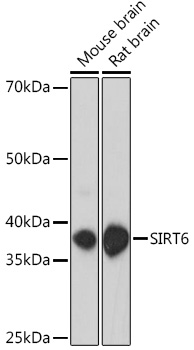 Surface staining of HLA-G1 transfectants (LCL-HLA-G1) using anti-HLA-G (MEM-G/9) FITC.