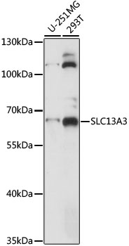 Western blot analysis of extracts of various cell lines, using SLC13A3 antibody (TA381546) at 1:1000 dilution. - Secondary antibody: HRP Goat Anti-Rabbit IgG (H+L) at 1:10000 dilution. - Lysates/proteins: 25ug per lane. - Blocking buffer: 3% nonfat dry milk in TBST. - Detection: ECL Basic Kit . - Exposure time: 5s.