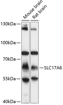 Total protein extract of normal human cerebral cortex separated as a strip on a 3- 12.5% gradient SDS-PAGE gel and Western blotted. The blot was probed with.