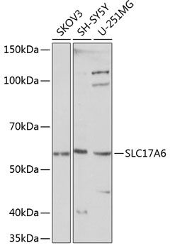 Total protein extract of normal human cerebral cortex separated as a strip on a 3- 12.5% gradient SDS-PAGE gel and Western blotted. The blot was probed with.