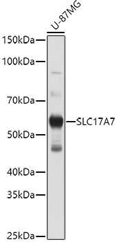 Western blot analysis of extracts of U-87MG cells, using SLC17A7 antibody (TA381561) at 1:1000 dilution. - Secondary antibody: HRP Goat Anti-Rabbit IgG (H+L) at 1:10000 dilution. - Lysates/proteins: 25ug per lane. - Blocking buffer: 3% nonfat dry milk in TBST. - Detection: ECL Basic Kit . - Exposure time: 10s.