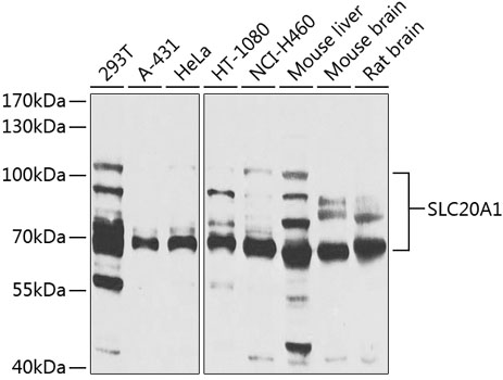 Western blot analysis of extracts of various cell lines, using SLC20A1 antibody (TA381573) at 1:1000 dilution. - Secondary antibody: HRP Goat Anti-Rabbit IgG (H+L) at 1:10000 dilution. - Lysates/proteins: 25ug per lane. - Blocking buffer: 3% nonfat dry milk in TBST. - Detection: ECL Basic Kit . - Exposure time: 15s.