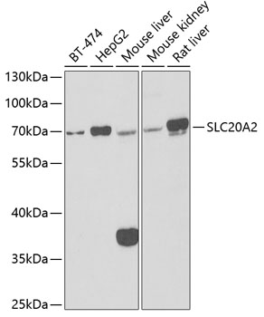 Western blot analysis of extracts of various cell lines, using SLC20A2 antibody (TA381574) at 1:1000 dilution. - Secondary antibody: HRP Goat Anti-Rabbit IgG (H+L) at 1:10000 dilution. - Lysates/proteins: 25ug per lane. - Blocking buffer: 3% nonfat dry milk in TBST. - Detection: ECL Basic Kit . - Exposure time: 90s.