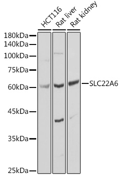 Western blot analysis of His-Ubiquitin recombinant protein probed with MOUSE ANTI HISTIDINE TAG:HRP (SM1693HRP).