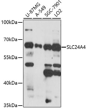 Western blot analysis of extracts of various cell lines, using SLC24A4 antibody (TA381591) at 1:1000 dilution. - Secondary antibody: HRP Goat Anti-Rabbit IgG (H+L) at 1:10000 dilution. - Lysates/proteins: 25ug per lane. - Blocking buffer: 3% nonfat dry milk in TBST. - Detection: ECL Enhanced Kit . - Exposure time: 90s.