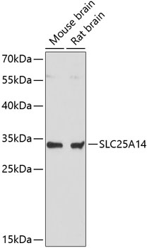 Western blot analysis of extracts of various cell lines, using SLC25A14 antibody (TA381596) at 1:3000 dilution._Secondary antibody: HRP Goat Anti-Rabbit IgG (H+L) at 1:10000 dilution._Lysates/proteins: 25ug per lane._Blocking buffer: 3% nonfat dry milk in TBST._Detection: ECL Basic Kit ._Exposure time: 90s.