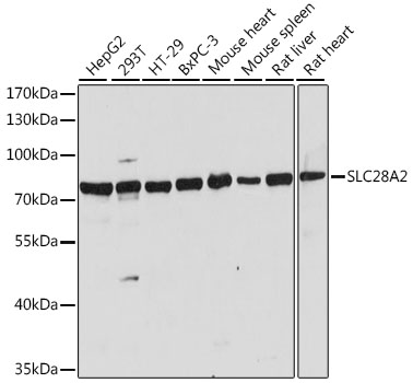 Western blot analysis of extracts of various cell lines, using SLC28A2 antibody (TA381624) at 1:1000 dilution. - Secondary antibody: HRP Goat Anti-Rabbit IgG (H+L) at 1:10000 dilution. - Lysates/proteins: 25ug per lane. - Blocking buffer: 3% nonfat dry milk in TBST. - Detection: ECL Basic Kit . - Exposure time: 5s.