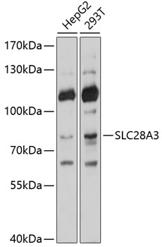 Western blot analysis of extracts of various cell lines, using SLC28A3 antibody (TA381625) at 1:1000 dilution. - Secondary antibody: HRP Goat Anti-Rabbit IgG (H+L) at 1:10000 dilution. - Lysates/proteins: 25ug per lane. - Blocking buffer: 3% nonfat dry milk in TBST. - Detection: ECL Basic Kit . - Exposure time: 1s.