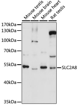 Western blot analysis of Jurkat human acute T-cell leukemia whole cell lysate probed with with anti Human CD3 antibody. followed by HRP conj ugated Goat anti Mouse IgG, visualized by chemiluminescence
